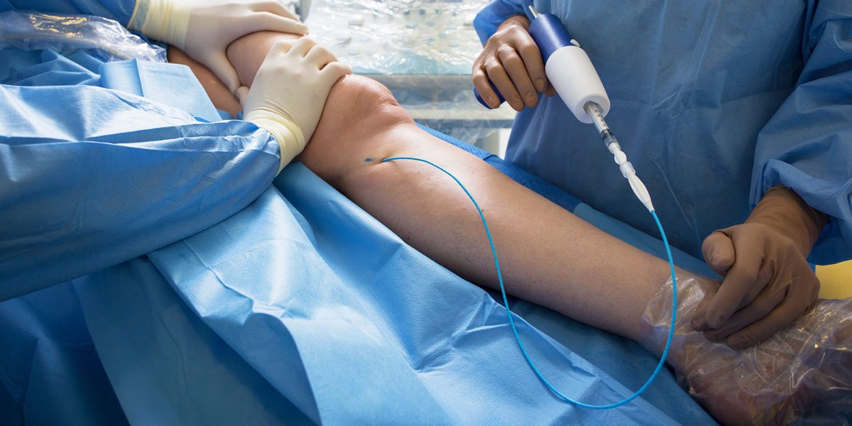 Healing Vessels, Saving Lives: The Impact of Vascular Surgeons